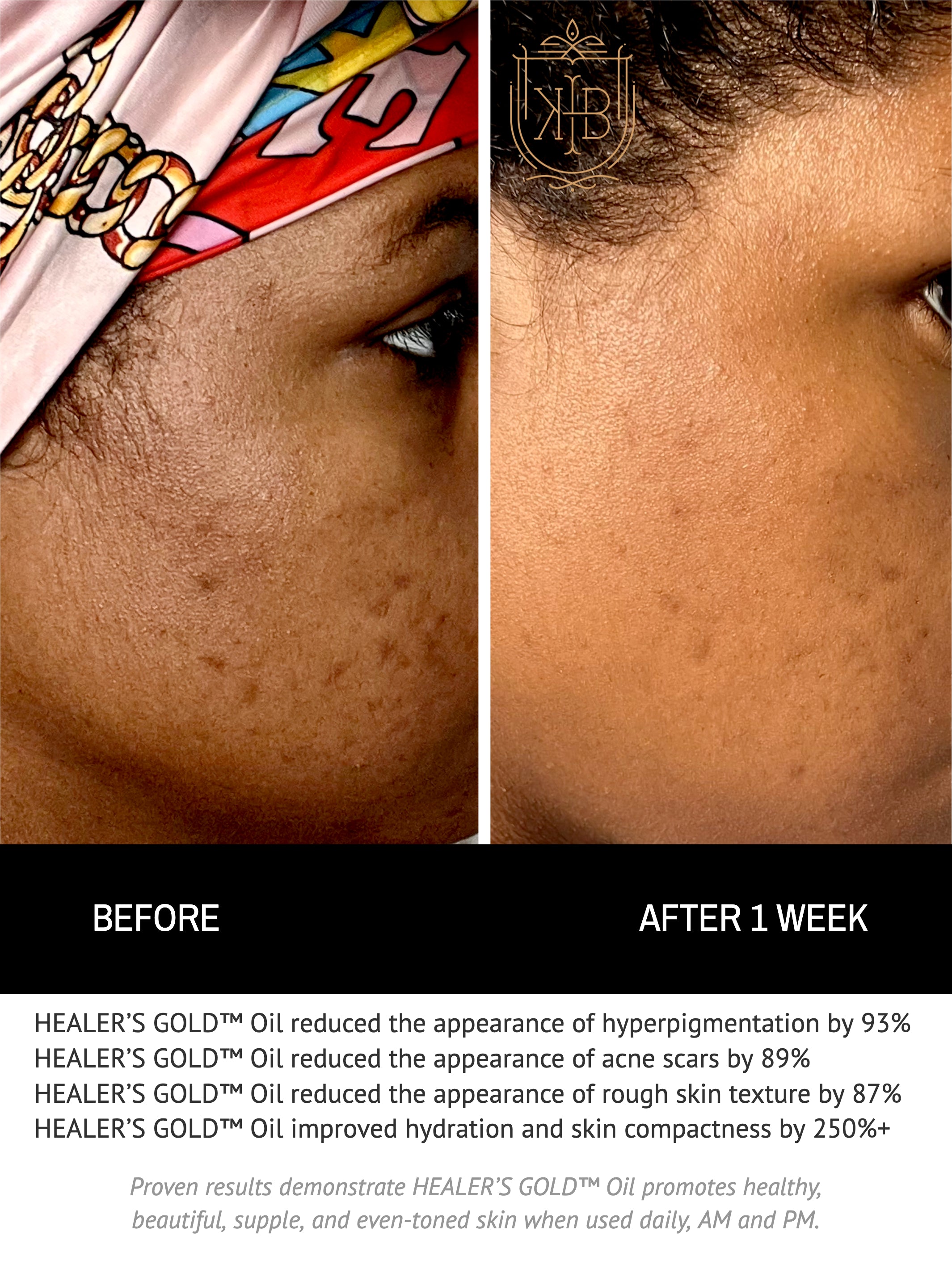 HEALER’S GOLD™ Oil