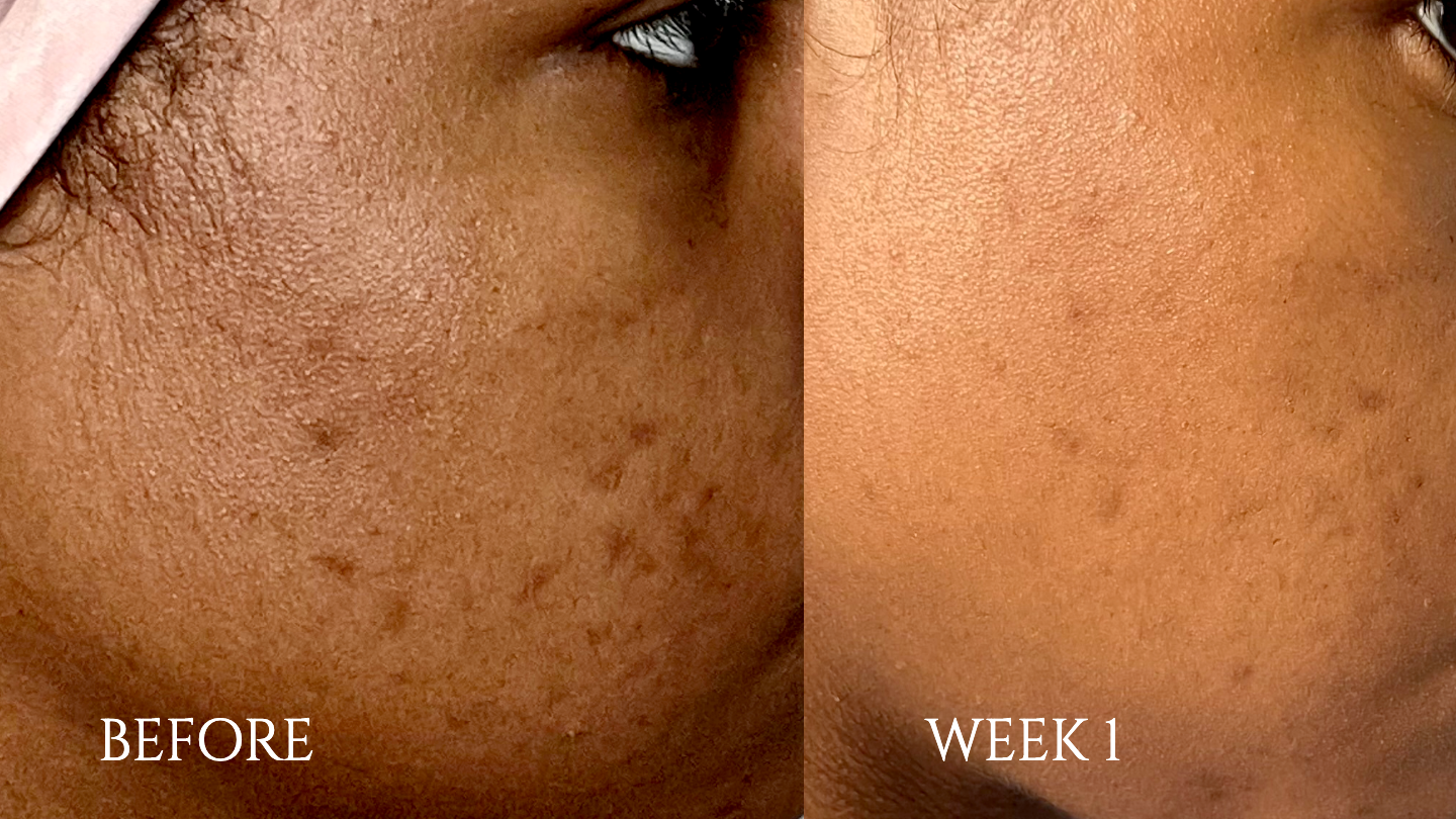 KOKOBÉRNA Repair